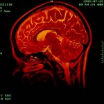brain-scan
